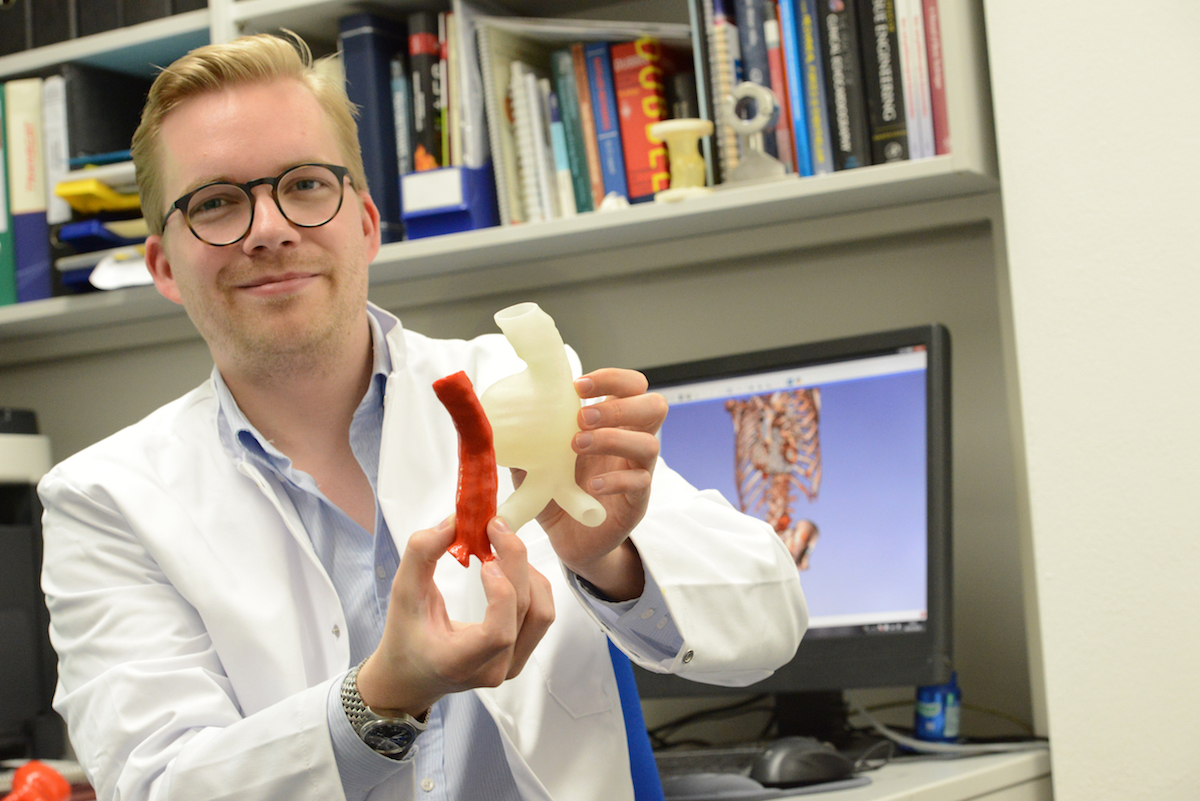 3D-Druck-Modell eines Gefäßaneurysmas (weiß) und der Form der späteren Gefäßprothese (rot) in den Händen von Dr. Nikolaus Thierfelder, Herzchirurg am Klinikum der LMU München (©A. Steeger/Klinikum LMU München)