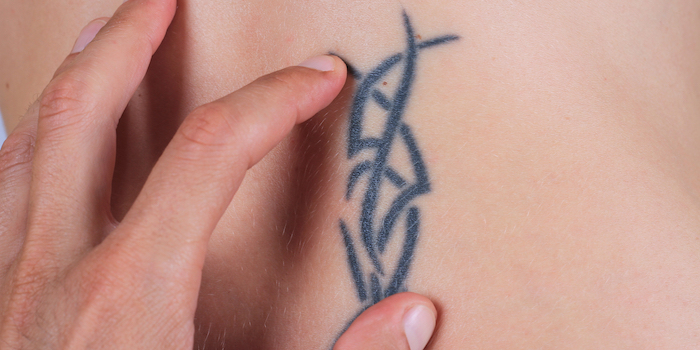 Tattoo im MRT: Erste prospektive Studie zur Risikobewertung