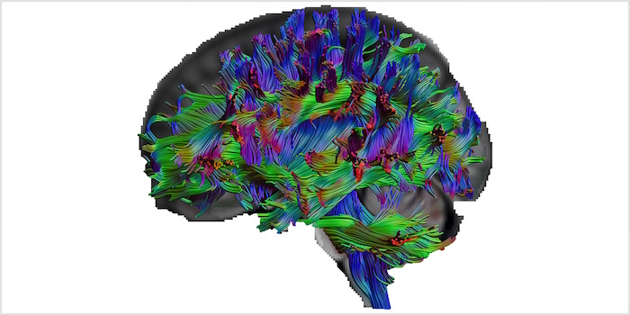 Diffusions-Tensor-Bildgebung: Zerebrale Vernetzung bei Menschen mit großem Allgemeinwissen
