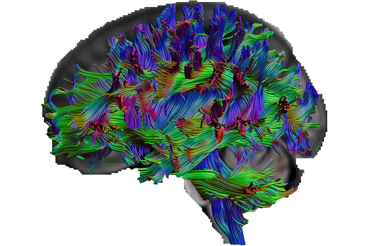 Mit der Diffusions-Tensor-Bildgebung lassen sich die Nervenfasern im Gehirn sichtbar machen (© RUB, Erhan Genç)