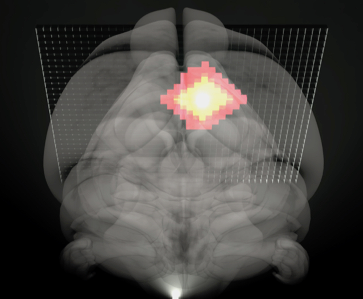 Kalzium-Ion-Veränderungen im Gehirn lassen sich mittels funktioneller MRT sichtbar machen (©Max-Planck-Institut für biologische Kybernetik)