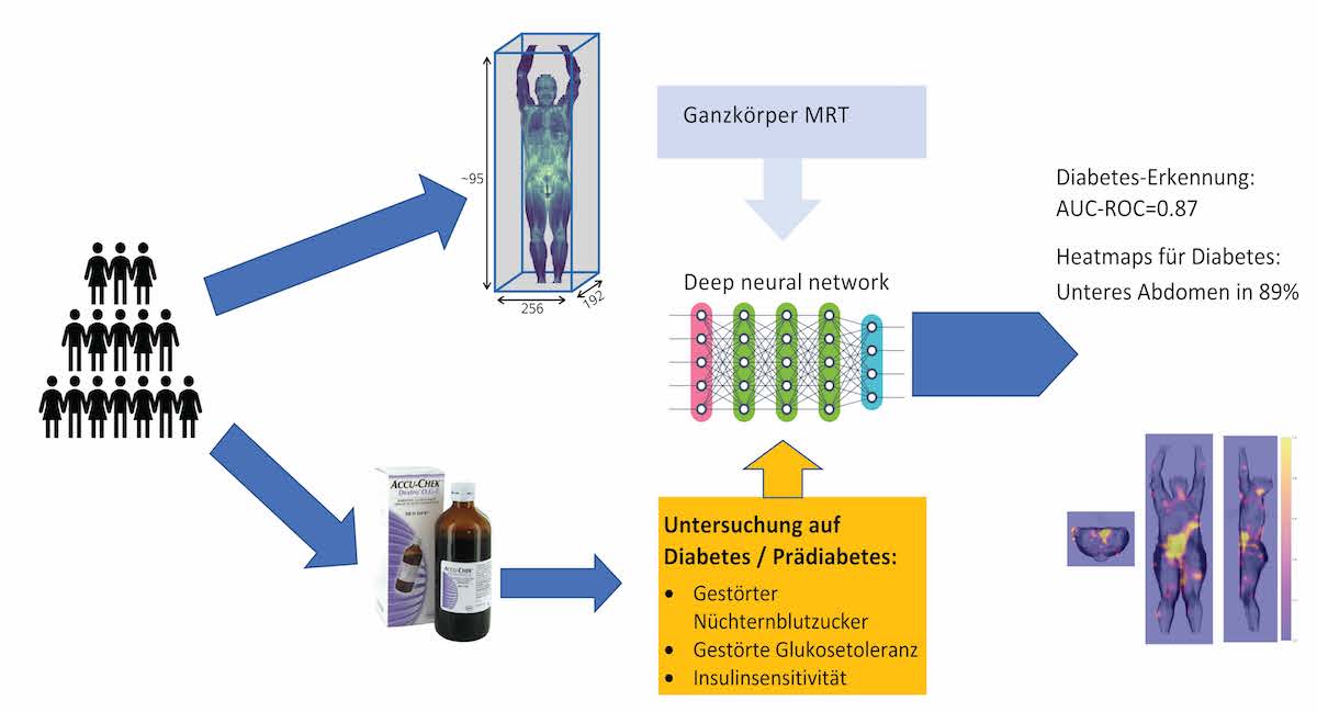 Diabetes-Erkennung aus Ganzkörper-MRT mit Deep-Learning (©IDM)