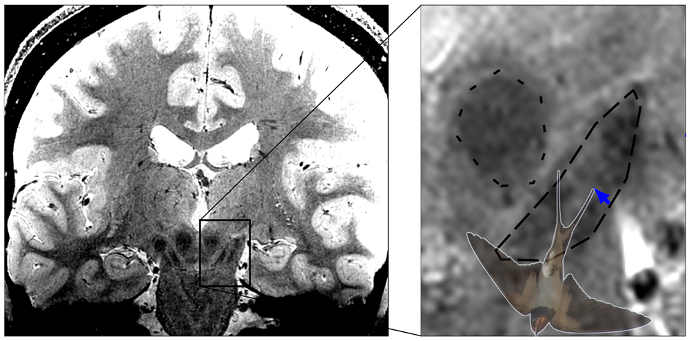 Mit hochaufgelöster MRT-Bildgebung ist die Abbildung des Schwalbenschwanz-Zeichens möglich, welches sich im hinteren Drittel der Substantia nigra befindet (© MPI CBS)