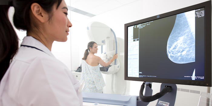 Mammographie-Screening: IQWiG empfiehlt Einbeziehen auch jüngerer und älterer Frauen