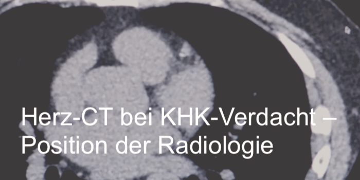 Herz-CT bei KHK-Verdacht – Position der Radiologie