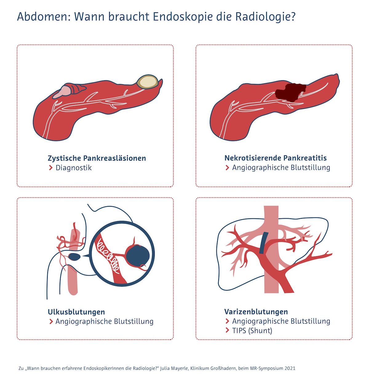 Indikationen für den Einsatz radiologischer Verfahren als Ergänzung zur Endoskopie