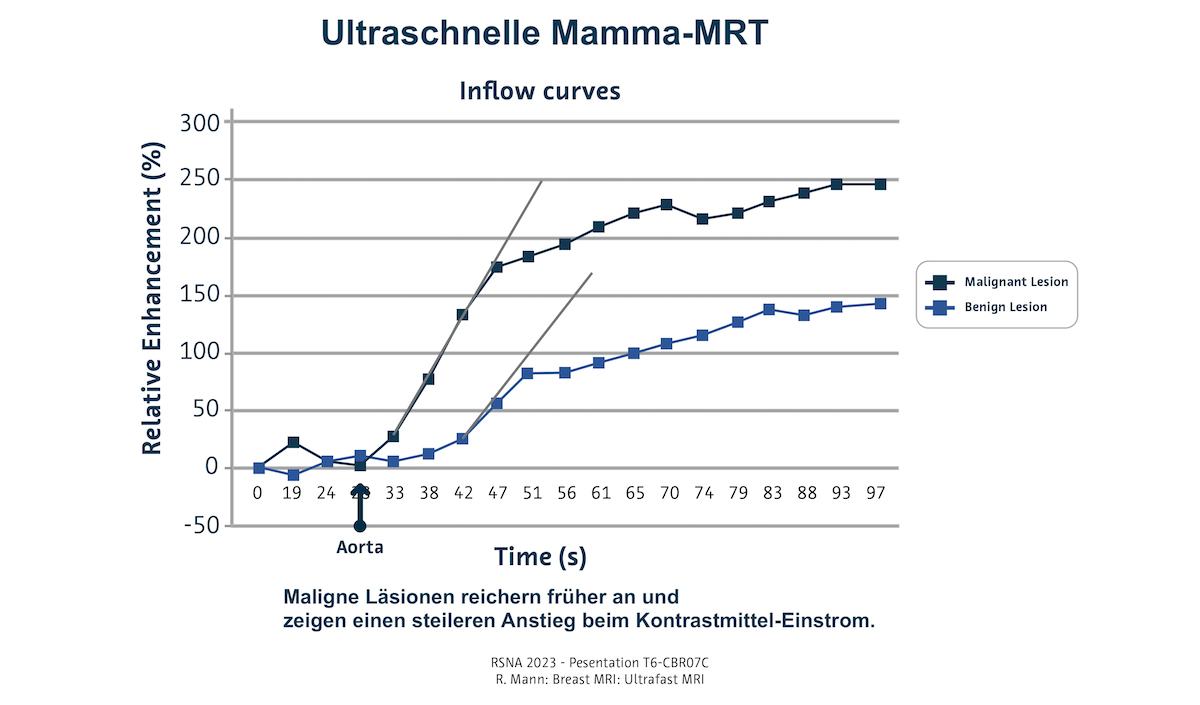 Ultraschnelle Mamma-MRT: Kontrastmittel-Einstrom