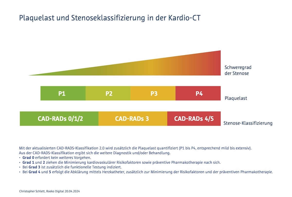 Plaquelast und Stenoseklassifikation in der Kardio-CT